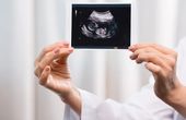 Making way for a digital twin of the human placenta