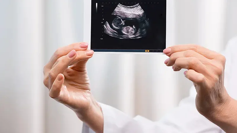 Making way for a digital twin of the human placenta