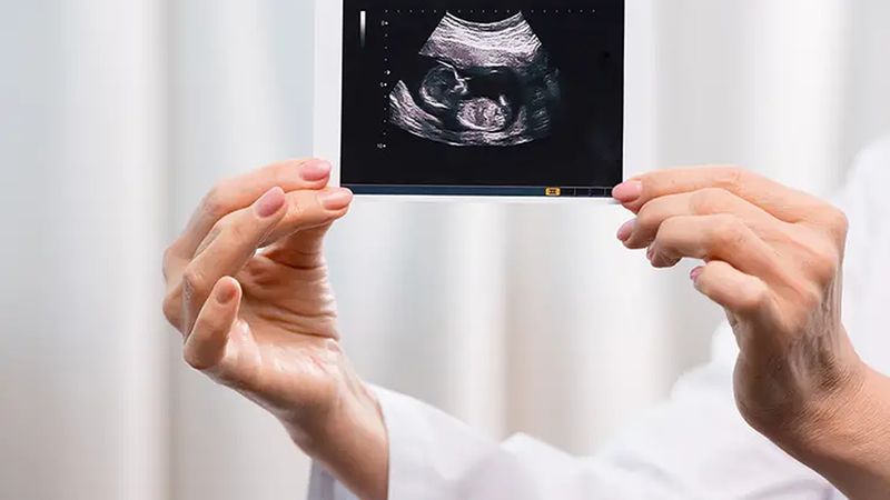 Making way for a digital twin of the human placenta