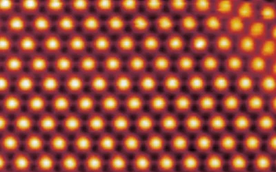 Unusual Superconductivity Observed in Twisted Trilayer Graphene