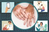 Startup lets doctors classify skin conditions with the snap of a picture