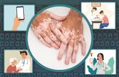 Startup lets doctors classify skin conditions with the snap of a picture