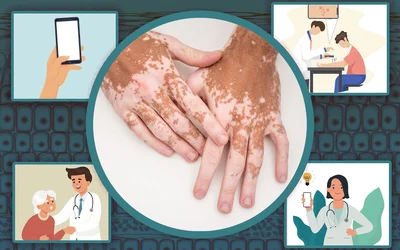 Startup lets doctors classify skin conditions with the snap of a picture