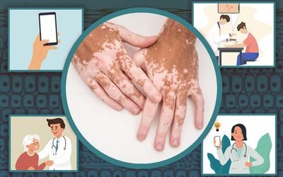 Startup lets doctors classify skin conditions with the snap of a picture