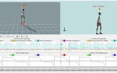 Advancing patient care with real-time balance biofeedback and Xsens analysis