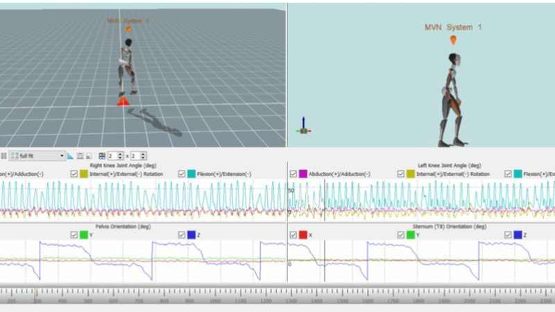 Advancing patient care with real-time balance biofeedback and Xsens analysis