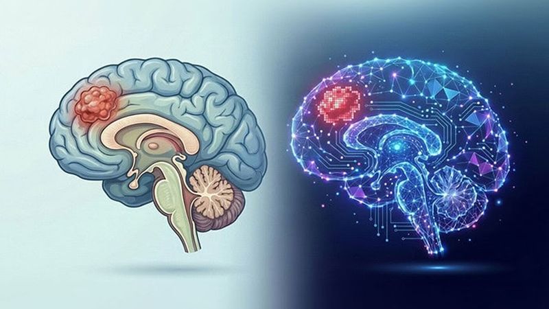 Illustration depicts a brain with a tumor and its digital twin. The glioma digital twin developed at U-M maps tumor metabolism and could help doctors discover whether a specific drug or diet is likely to slow tumor growth in an individual patient. Credit: Google Gemini