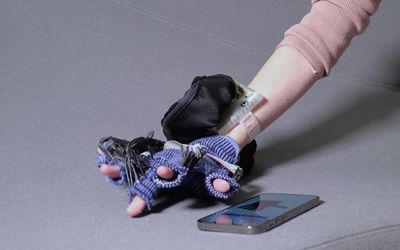 EdemaFlex: soft-robotic glove for swelling relief