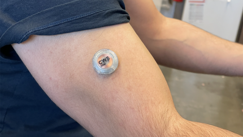Multi-tasking wearable continuously monitors glucose, alcohol, and lactate