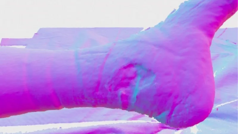 3D scan of a chronic wound