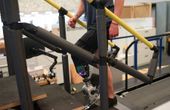 A prosthesis driven by the nervous system helps people with amputation walk naturally
