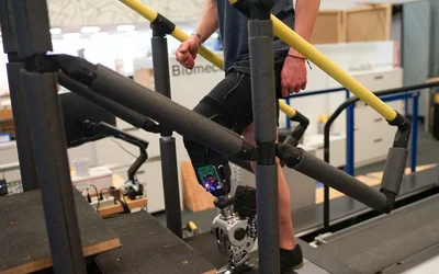 A prosthesis driven by the nervous system helps people with amputation walk naturally