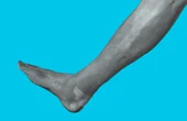 Scanning a human body part