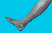 Scanning a human body part