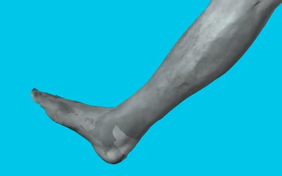 Scanning a human body part