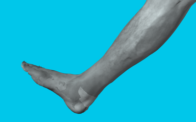 Scanning a human body part