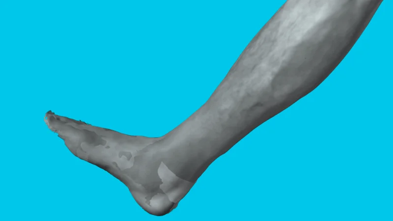 3D leg scan
