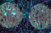 Is the bone implant of the future a hydrogel?