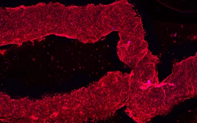 3D-printed blood vessels bring artificial organs closer to reality