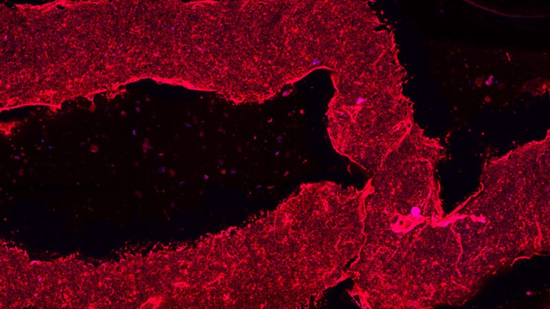 Co-SWIFT vessels are embedded with living smooth muscle cells and endothelial cells to replicate the structure of human blood vessels in vitro. (Wyss Institute at Harvard University)