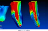 The Creaform Health Care Partner 3D Scanner Makes Life Easier For Doctors And Patients Alike!