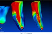 The Creaform Health Care Partner 3D Scanner Makes Life Easier For Doctors And Patients Alike!