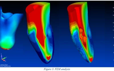 The Creaform Health Care Partner 3D Scanner Makes Life Easier For Doctors And Patients Alike!