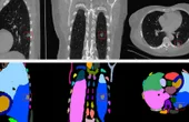 Real-world Applications of Generative AI at the Edge